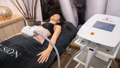 Sesión de criolipólisis