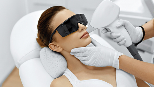 Depilación facial con láser de diodo