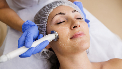 Tratamiento de radiofrecuencia facial